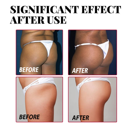 Plump Buttock Cream Lig En Versterk Billetjies