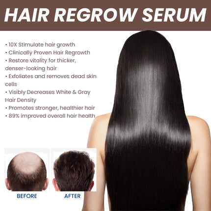 EELHOE Haardigtheidsessens Haar teen haarverlies en haarvasleggingsvoeding