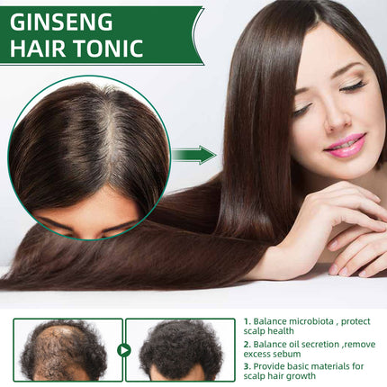 Ginseng Haar Groei Vloeistof Spuit Om Haarverlies Te Voorkom
