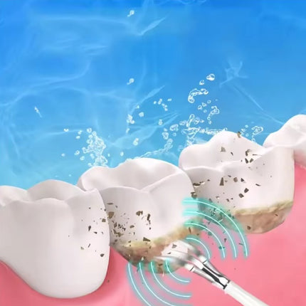 Smart Ultra-Sonic Teeth Cleaner