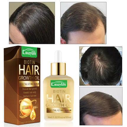 Haar Hareversorging Essensiële Olie 30ml Sag En Verfrissend