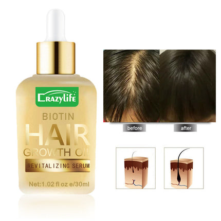 Haar Hareversorging Essensiële Olie 30ml Sag En Verfrissend