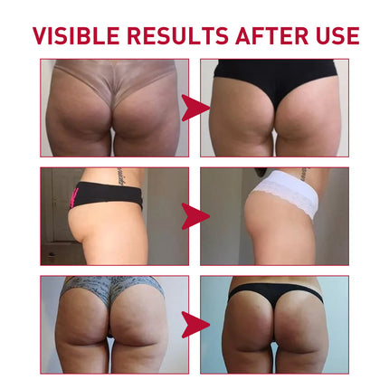 Plump Buttock Cream Lig En Versterk Billetjies