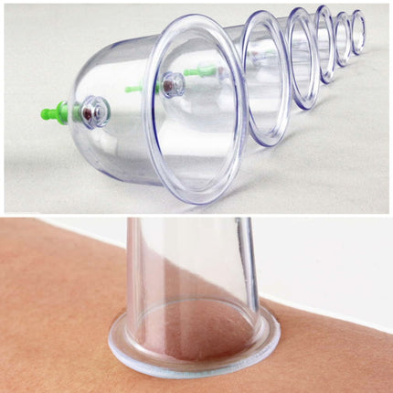 Chinese Great Medical Body Healthy Care 12 Koppies Kit Koppie Terapie Koppies Warm Verkoper