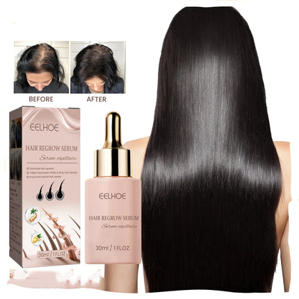 EELHOE Haardigtheidsessens Haar teen haarverlies en haarvasleggingsvoeding