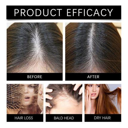 Marjoran Mi Hair Oil Moisture Replenishment Hair Essence For Repairing Dry And Manic Hair