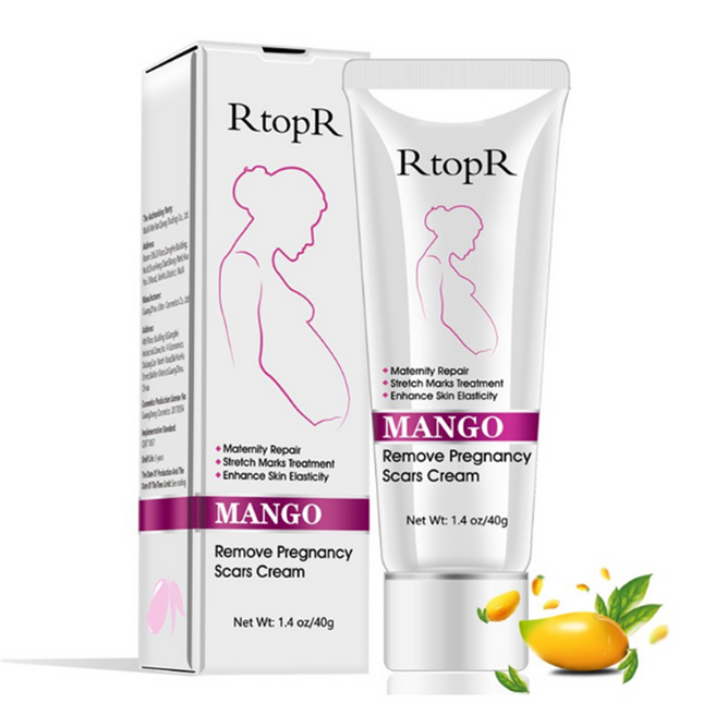 Natuurlike Sagte Nie-irriterende Mango Rekmerke Verwyderaar Room Vir Swangerskap Herstel Litteken Verslapping Lyne Abdomen Rekmerke Room