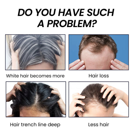 EELHOE Haardigtheidsessens Haar teen haarverlies en haarvasleggingsvoeding