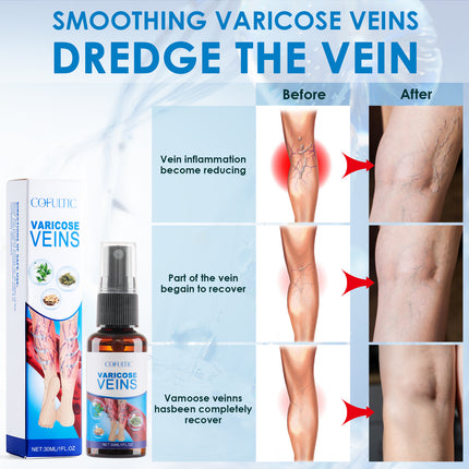 30ml Spatare Spuit Veeldoelige Knie- en Beenversorgingspuit Bevorder Bloedsirkulasie