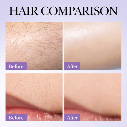 Hair Growth Inhibition Armpit Leg Hair Spray
