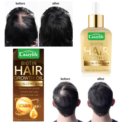 Haar Hareversorging Essensiële Olie 30ml Sag En Verfrissend