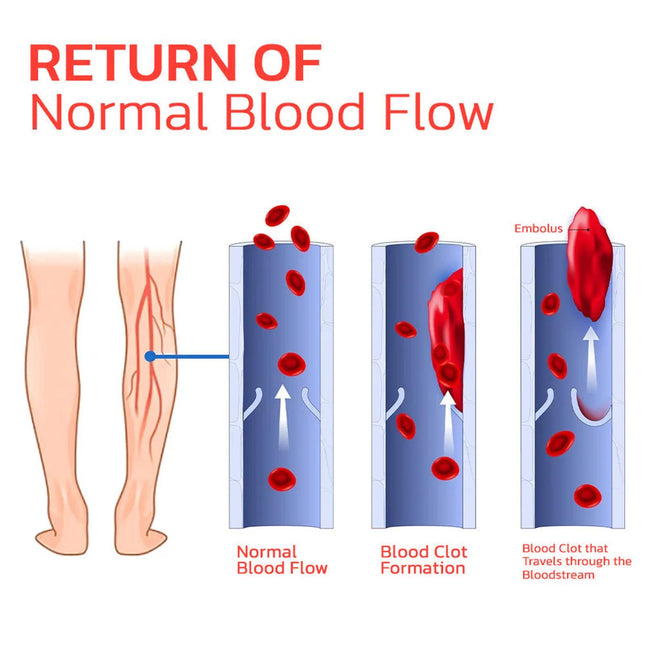 Arch Support, Anti-slip And Wear-resistant Body Care, Slimming And Body Shaping, Vein Repair Insoles