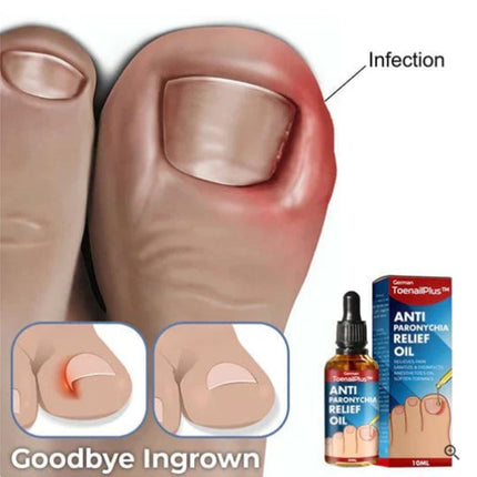 Bright Nail Repair Thickened Nail Groove Treatment Oil