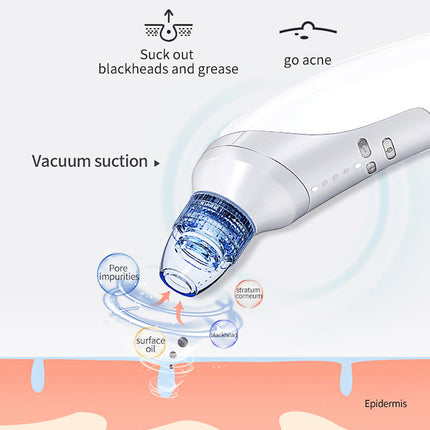 Swartkop-suiginstrument, Elektriese swartkop-suigapparaat, Swartkopverwyderingsinstrument, Skoonheidsinstrument vir tuisgebruik om swartkoppies en aknee te suig
